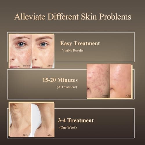 MEGELIN Led Red Light Therapy Face & Neck Mask, 7 Colors Led Light Therapy Facial Mask, Infrared Red Light Therapy Mask, Infrared Light Skin Rejuvenation(White) - Thumbnail 4