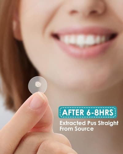 Pimple Patches for Face, Hydrocolloid Acne Patches with Tea Tree Oil for Spot Treatment, Zit Patch, Blemish Cover, Two Sizes, Vegan, Cruelty Free (144 Count (Pack of 1)) - Thumbnail 2