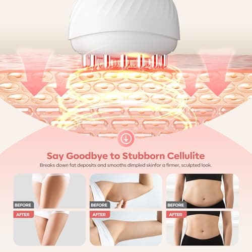 HarrFlow Lymphatic Drainage Massager & Anti Cellulite Massage Tool,New Lymphatic Massager,Helps Reduce Stretch Marks & Cellulite，for Belly, Arms & Legs,Body Sculpting Machine with Heat & Vibration - Thumbnail 3