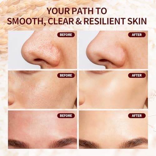 Jeirrzi Peeling Shot Glow Rice Exfoliant Ampoule, 5% Complext Acid Gentle Exfoliating Serum with Salicylic Acid, Brightening and Smoothing for Sensitive Skin - Thumbnail 6