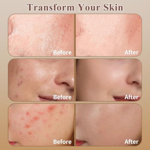 WEAUUP Beef Tallow for Skin, Organic Grass Fed Whipped Beef Tallow Balm, Tallow and Honey Balm with Raw Honey and Beeswax, Nourishing Moisturizer for Face & Body Natural Skin Care for Soft - Thumbnail 4