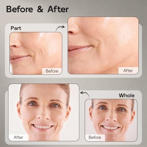 Retinol Serum for Face & Neck, Anti Aging B5 Resurfacing Face Serum with Niacinamide + Collagen + Hyaluronic Acid, Smooths Wrinkles & Fine Lines, Dark Spot Corrector, Brighten Dullness - Thumbnail 2