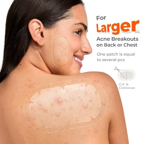 XXL Pimple Patches for Body, Large Acne Patches, 5 Sizes Big Hydrocolloid Bandages for Back, Chest, Shoulders Zit Breakouts, Blemish Stickers for Face (Oval, Dot 110 Count) - Thumbnail 3