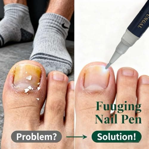 YLTNEUQER Toenail Fungi Treatment Extra Strength & Fungi Nail Pen - 4Pcs Nail Repair Pen, Targeted Solution for Nail Health Concerns (Athletes Ideal), 4ml/0.14FLOZ - Thumbnail 5