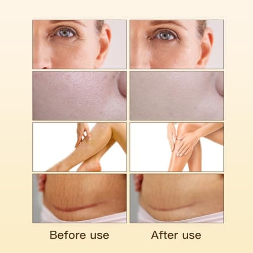 UWPU-Frankincense Oil, Frankincense Oil for Face, Natural Extraction of Bakuchiol, Reduce Wrinkles, for Scars, Gentle Skincare for Day & Night Cold Extracted Facial Oil, for all Skin Types - Thumbnail 3