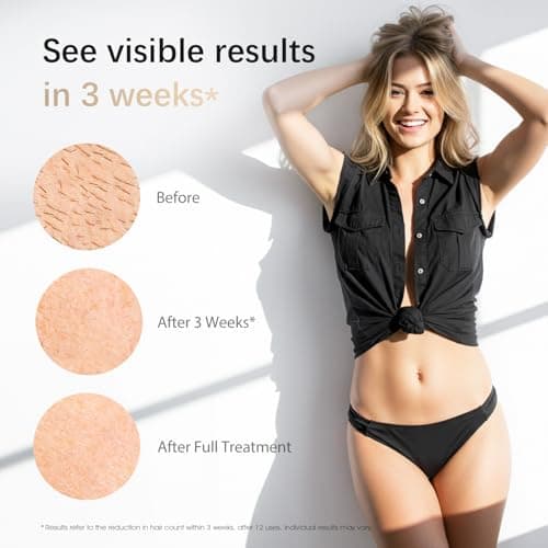 IPL Laser Hair Removal Device for Women & Men - Safe At-Home 45°F Ice-Cooling Contact for Painless & Long-Lasting Results, 86% Less Hair In 3 Weeks for Full Body & Face, Pure White - Thumbnail 3