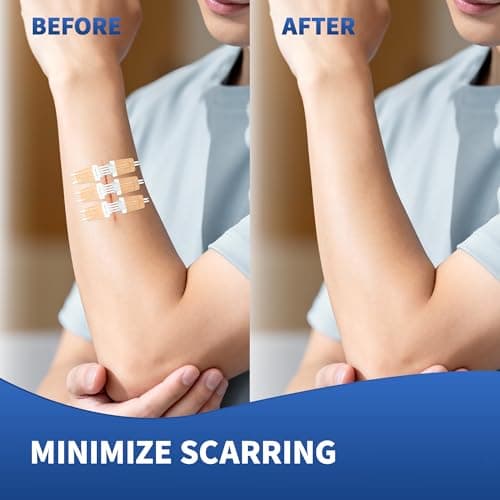 RYNORA 6 Pack Wound Closure Strips Butterfly Bandages(0.8"x 3"),Repair Wounds Without Stitches, Quick Clot Zip Stitch Wound Closures Device for First Aid Kits, Outdoor Activities, and Home Use - Thumbnail 4