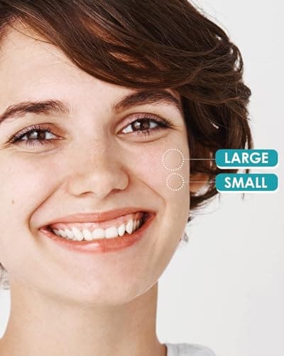 Pimple Patches for Face, Hydrocolloid Acne Patches with Tea Tree Oil for Spot Treatment, Zit Patch, Blemish Cover, Two Sizes, Vegan, Cruelty Free (144 Count (Pack of 1)) - Thumbnail 3