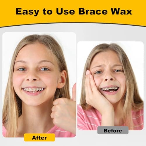 ACSKD 180PCS Braces Wax,Orthodontic Wax with Individual Packaging,Dental Waxs for Brace Travel Home Office,Unflavored - Thumbnail 4