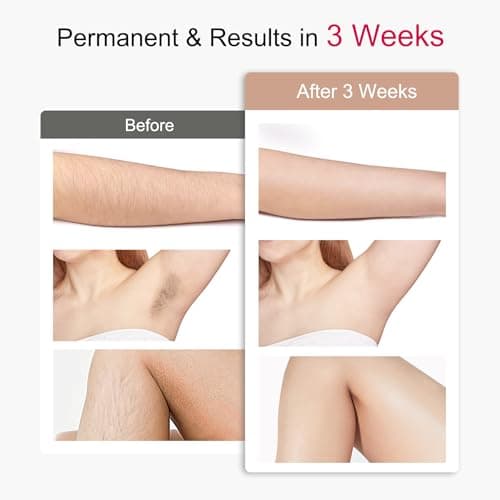 Avemoi Laser Hair Removal, IPL Laser Hair Removal for Women and Men with 41°F Ice Cooling, Five Painless Smart Modes for Full Boby, 90% Visible Hair Reduction in 3 Weeks - Thumbnail 5