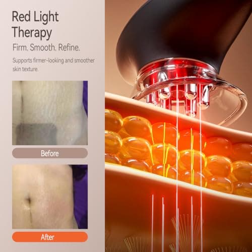 Zelvory 3-in-1 Body Sculpting Machine with Vacuum, Microcurrent & Red Light - Thumbnail 5