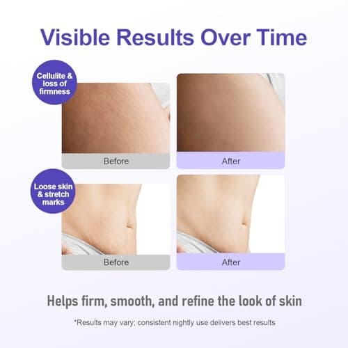 Dreamy Glow Overnight Toning Whip Cream – LIFTONIN® Anti-Cellulite & Get Body Firming Cream with Satin Eye Mask, Smooths Belly, Thighs & Booty 3.38 fl oz - Thumbnail 4
