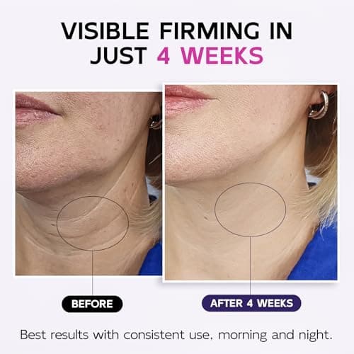Neck Firming Cream with Roller, Tighten & Lift Neck & Chest Moisturizing Cream, Anti-Aging, Smooths Wrinkles & Crepey Skin, Visibly Firming, Multi-Peptide, Retinol, Collagen, Hyaluronic Acid 4.3 Fl Oz - Thumbnail 2
