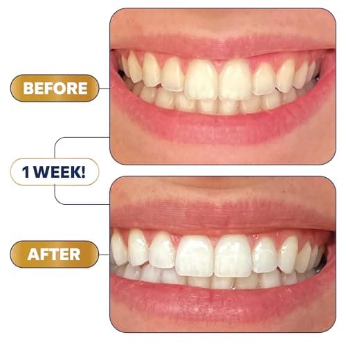 Lumineux Teeth Whitening Strips - 35 Treatments (6 Months) – Peroxide Free - Enamel Safe for Whiter Teeth - Whitening Without The Sensitivity - Dentist Formulated - Sensitivity Free - Thumbnail 3