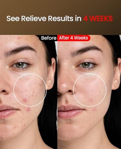 Facego Red Light Mask for Face, 7-1 Colors Red Light Face Mask, Cordless Red-Light Facial Mask with Eye-Protection, Rechargeable for Skincare at Home & Travel - Thumbnail 4