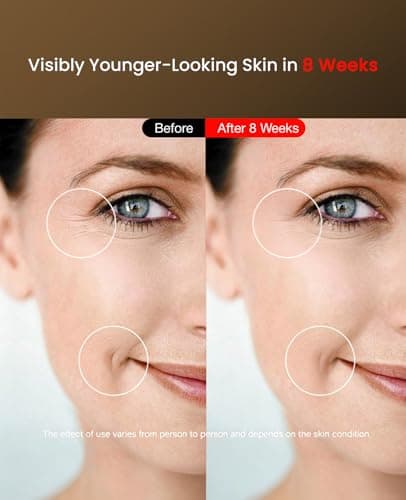 Facego Red Light Mask for Face, 7-1 Colors Red Light Face Mask, Cordless Red-Light Facial Mask with Eye-Protection, Rechargeable for Skincare at Home & Travel - Thumbnail 3