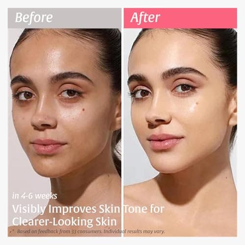 Nutralessece 10% Niacinamide, 4% Tranexamic Acid Serum for Dark Spots, Brightening & Even Skin Tone – Alpha Arbutin & Multi-Hyaluronic Acid Hydrating Essence, for All Skin Types, 1.0 fl oz - Thumbnail 2