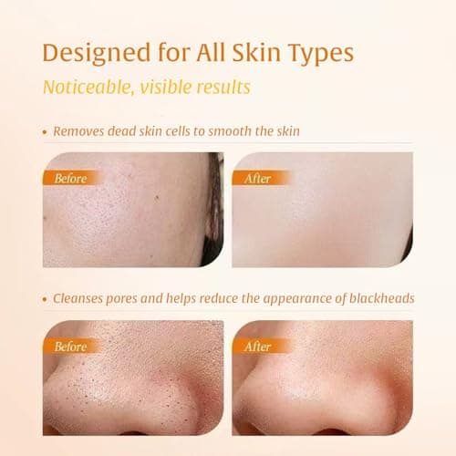 Turmeric Kojic Acid Exfoliating Gel – Brightening Peeling Gel, Deep Pore Cleanser Minimizer Exfoliator, Face Scrub Dead Skin Cells Remover, Blackhead Remover, Korean Skin Care, 142g/5oz - Thumbnail 3