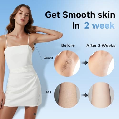 IPL Hair Removal Device,JR9 - Thumbnail 6