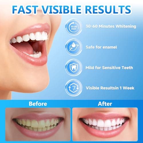 Milumber Teeth Whitening Strips for Sensitive, 42 Strips Whitener Safe Whitestrip, Deep Stains Removal Tooth Whitening, Enamel Safe Non-Slip Dry Strip Technology for Whiter Teeth, Mint - Thumbnail 3