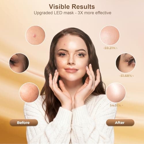 AIUO Red Light Therapy for Face, Led Face Mask Light Therapy with Rechargeable Remote, LED Face Mask Light Therapy at Home, Comfortable Red Light Therapy Mask, Black - Thumbnail 3