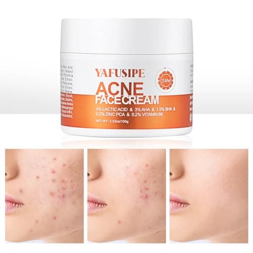 YAFUSIPE Acne Treatment for Face for Hormonal Cystic Stubborn Acne Cream for Sensitive Skin Teens Adults Women Men Spot Pimple Butt Control Rapid Clearing Breakout Overnight Face Blemish Treatment - Image 1