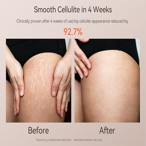 Zelvory 3-in-1 Body Sculpting Machine with Vacuum, Microcurrent & Red Light - Thumbnail 2
