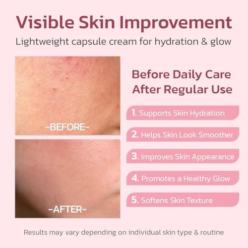 Jorceray PDRN Pink Collagen Capsule Cream – Salmon PDRN - Dual Texture Barrier Repair Moisturizer | Salmon DNA + 5% Niacinamide 2oz - Thumbnail 4