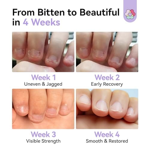 SAVILAND Nail Biting Prevention for Adults Pen - Extra Bitter Nail Biting Treatment Natural Stop Biting Nails Adults Quick Dry No Bite Thumb Sucking Deterrent Nail Polish Repair for Damaged Nail 5ml - Thumbnail 6