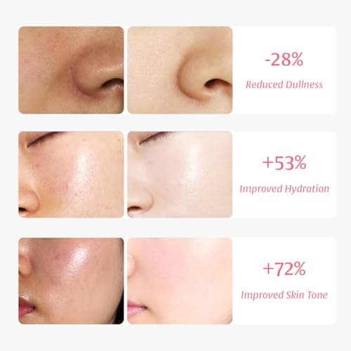 Nutralessece 10% Niacinamide, 4% Tranexamic Acid Serum for Dark Spots, Brightening & Even Skin Tone – Alpha Arbutin & Multi-Hyaluronic Acid Hydrating Essence, for All Skin Types, 1.0 fl oz - Thumbnail 3