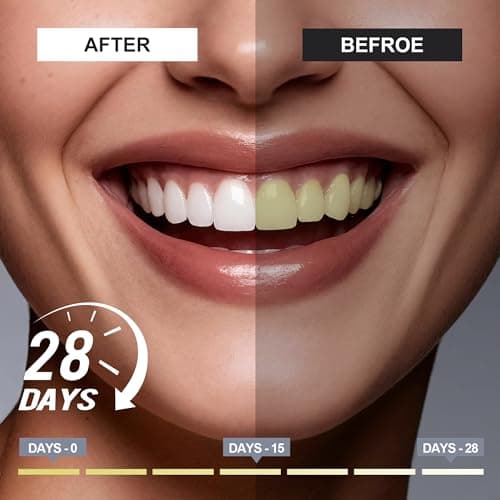 Woadee Hydroxyapatite Toothpaste for Advanced Enamel Protection, Fluoride-Free Nano Hydroxyapatite Toothpaste, Gentle and Effective Formula, Fresh Breath, Suitable for Sensitive Teeth 4 Pack - Thumbnail 2