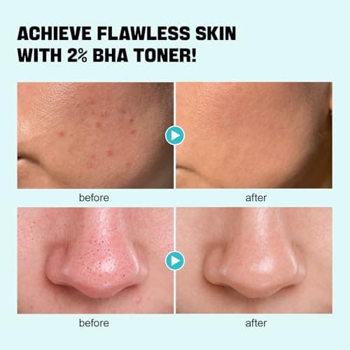 ZealSea Salicylic Acid Toner, Blackhead Remover, BHA Liquid Exfoliant (CICA, 6.76OZ), Pore Minimizer for Face, Gentle Alcohol Free BHA Toner for All Skin Type with Niacinamide, Redness Relief, Vegan - Thumbnail 3