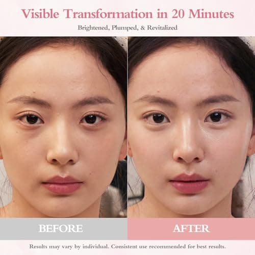 GrlGrl PDRN Under Eye Patches for Puffy Eyes and Dark Circles, 5000ppm Salmon DNA & Retinal Eye Mask for Face, Anti Aging Hydrogel Eye Gels for Smile Line, Wrinkles & Bags, 60 Pcs - Thumbnail 3