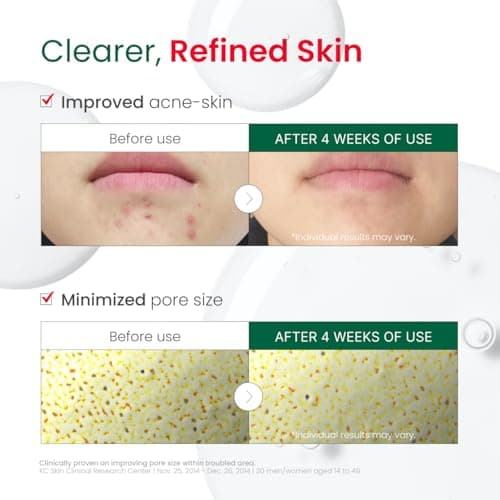 Dr. G R.E.D. Blemish Clear Hyal-Cica Soothing Serum - Korean Skincare - Long-Lasting, Hydrating Serum for All Skin Types - Cools Skin Temperature - Hyaluronic Acid & Centella Asiatica - 1.69 fl oz - Thumbnail 5