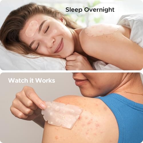 XXL Pimple Patches for Body, Large Acne Patches, 5 Sizes Big Hydrocolloid Bandages for Back, Chest, Shoulders Zit Breakouts, Blemish Stickers for Face (Oval, Dot 110 Count) - Thumbnail 5