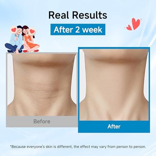 Neck Mask 8PCS, HONLINK Hydrolyzed Collagen Neck Mask Set with Hyaluronic Acid & Peptide,Moisturizing Firming Masks for Crepey Skin, Helps Reduce the Appearance of Fine Lines for Smoother-Looking Skin - Thumbnail 4