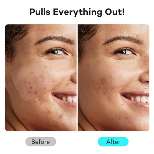 LitBear Large Pimple Patches for Face (6 Sizes 118 Pcs), Big Hydrocolloid Acne Patches, XL Hydrocolloid Bandages for Body, Cheek, Forehead, Chin, Full Face, Back, Nose - Thumbnail 4