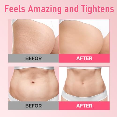 MythosFlow Cellulite Cream, Butt Firming and Lifting Cream - Reduce Cellulite Appearance | Reduce Loose & Stretch Mark Skin Tightening Cream for Body Booty, Legs & Belly Enhances Curves 3.72 fl.oz - Thumbnail 3