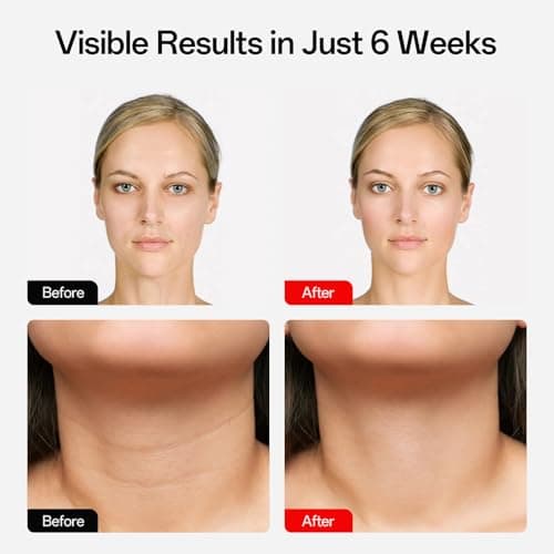 Facego Red Light Mask for Face and Neck, 7 Colors Red Light Face Mask with Rechargeable Remote Controller, Flexible, Portable, Lightweight, and Ergonomic for Home & Travel (Black) - Thumbnail 4