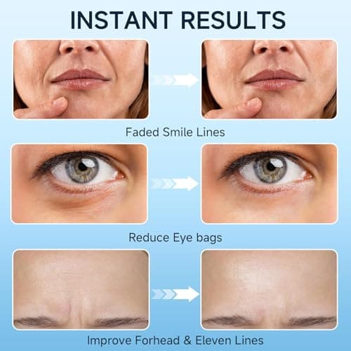 Under Eye Cream, Retinol Cream for Eye Bags and Wrinkles, Eye Bag Treatment for Men Women, Eye Cream with Caffeine for Dark Circles and Puffiness Tightener, 15ml/0.5 fl.oz - Thumbnail 4