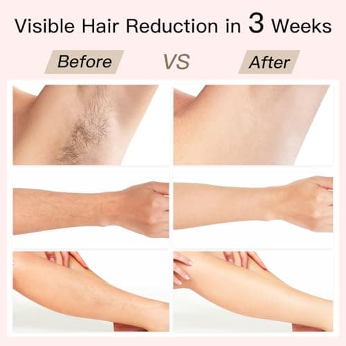 Laser Hair Removal, BoSidin IPL Hair Removal with Painless Ice-Cooling, 2-in-1 Face SR Rejuvenation, 6+1 Modes, 6 Levels Hair Removal for Women Permanent, Laser Hair Removal Kit with Shaver, Goggles - Thumbnail 3
