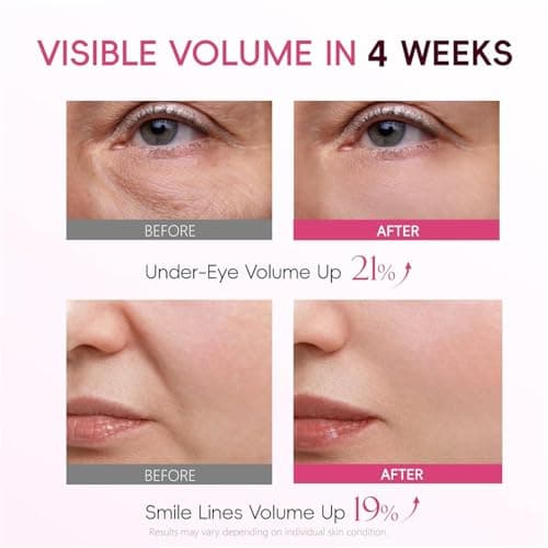 APBM Volufiline Plumping Serum for Face | 5% Volufiline + 3% Niacinamide + 1% Multi-Peptide | Visible Volume for Under-Eye & Smile Lines | For Fuller, Radiant-Looking Skin, Boost Collagen | 1.01 fl oz - Thumbnail 2