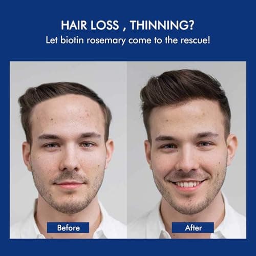 Ceson&Cesun Rosemary & Biotin Hair Growth Thickening Shampoo for Men | Anti-Thinning Hair Strengthening | Hydrate Cleanse Hair & Scalp | Hair Regrowth Shampoo, Dry Damaged Hair Care For Men and Women - Thumbnail 4