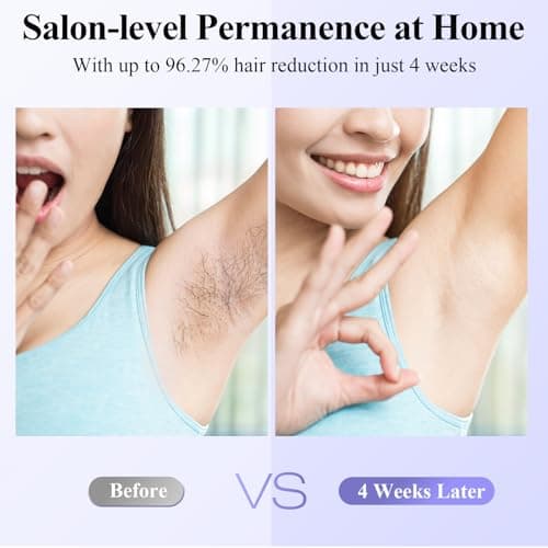 Xsoul Laser Hair Removal with Sapphire 5℃ Ice Cooling, Painless & Permanent IPL Laser Hair Device for Women Men, 2 Modes, 5 Levels, 999,999 Flashes, at Home Hair Remover for Bikini, Armpit & Face - Thumbnail 5