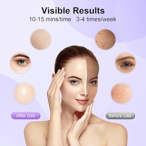 XANBYYE Red Light Therapy for Face, LED Face Mask Light Therapy Adjustable Brightness with 7-Color LED Facial Mask, Red Light Mask for Anti-Aging,Rechargeable Light Care Beauty Device for Home Use - Thumbnail 2