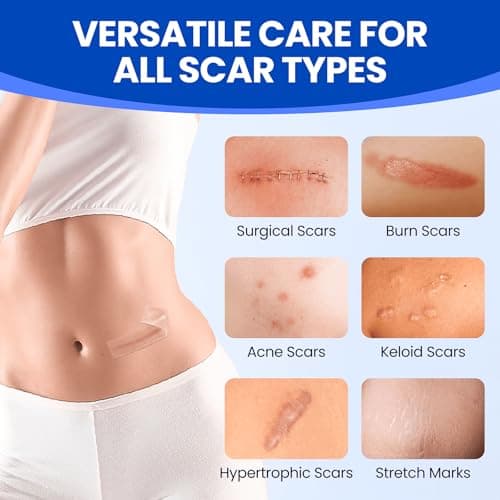 Silicone Scar Sheets Surgical Tape (1.6”x120” Roll) Face Patches Acne Treatment C Section Strips, Skin-Sensitive Medical Grade Healing Scar Bandages Pads for Keloid, Stretch and Tummy Tuck Recovery - Thumbnail 3