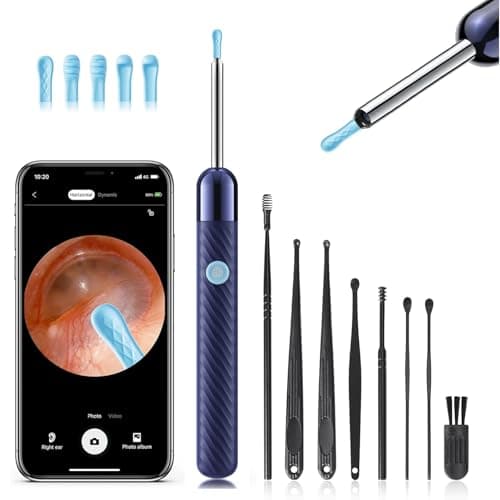Loyker Ear Wax Removal, Ear Cleaner with Camera with 1080P, Otoscope with Light, Ear Wax Removal Kit with 6 Ear Pick, Ear Camera for iPhone, iPad, Android Phones (Blue) - Image 1