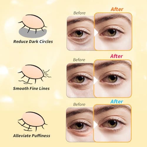 Under Eye Patches(25 Pairs), 24K Gold, Caffeine, Retinol Eye Masks for Puffy Eyes, Wrinkles, Dark Circles, Undereye Bags Treatment - Restoring & Awakening & Moisturizer Skin care Gift for Women - Thumbnail 4