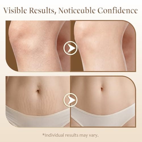 Magic Body Firming Oil After Shower Body Oils for Women with Massage Roller | Tighten, Hydrate, Crepe Erase, Anti Cellutite with DEFENSIL®, Vitamin E & Natural Botanicals (5.07 fl.oz.) - Thumbnail 3