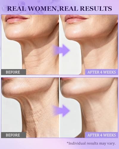 Neck Firming Cream for Tightening | Anti-Aging Face Moisturizer for Women | 1% Retinol + 7% Hyaluronic Acid for Firming & Wrinkle Reduction | Day & Night Use for Neck & Décolleté, 1.7 Fl Oz - Thumbnail 5